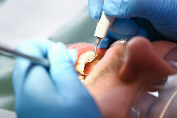 Best Emergency Denture Repair in Menlo Park, CA