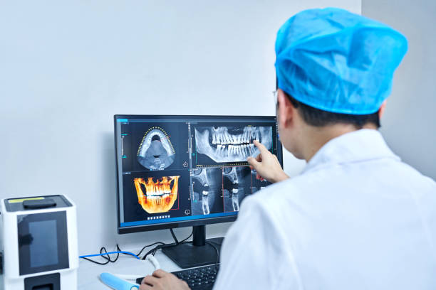 Best Emergency Care for Gum Disease in Menlo Park, CA